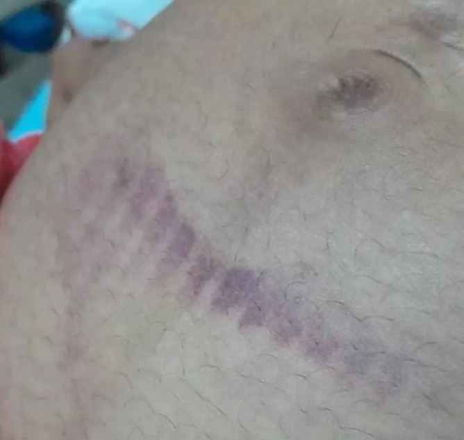 Mulher grávida é agredida e perde o bebê após confusão na cavalgada de Buritirana